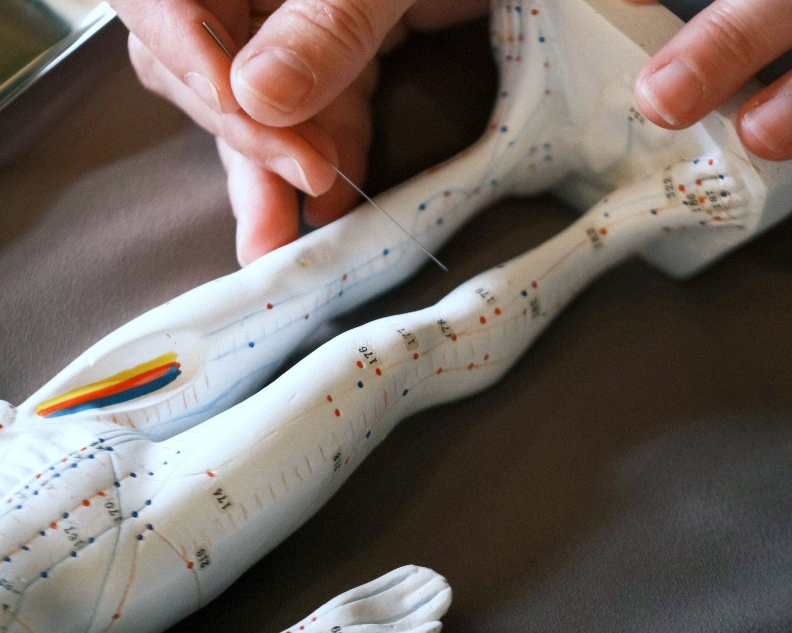 Different Styles of Acupuncture | Holistic Healing Techniques